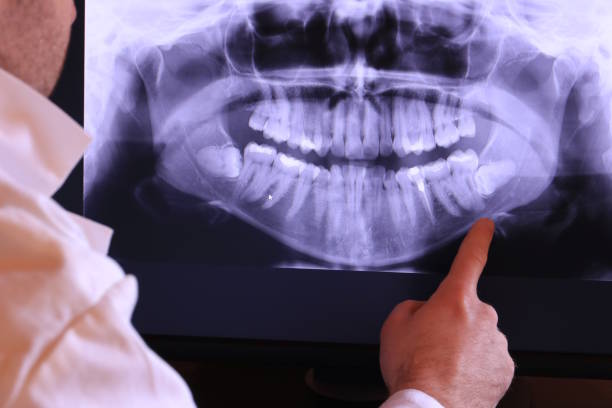 Best Emergency Treatment for Dental Infections or Abscesses in Whiting, WI