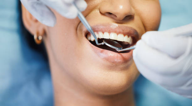 Best Emergency Tooth Extraction in Whiting, WI
