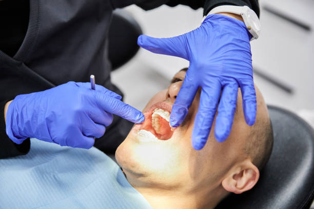 Best Emergency Tooth Extraction in Whiting, WI